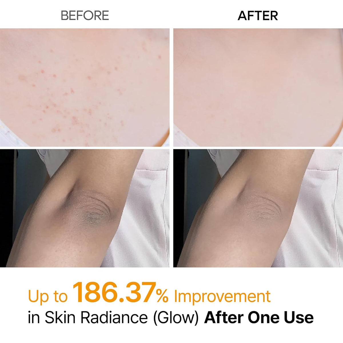 Advanced Glass Skin Peeling Solution