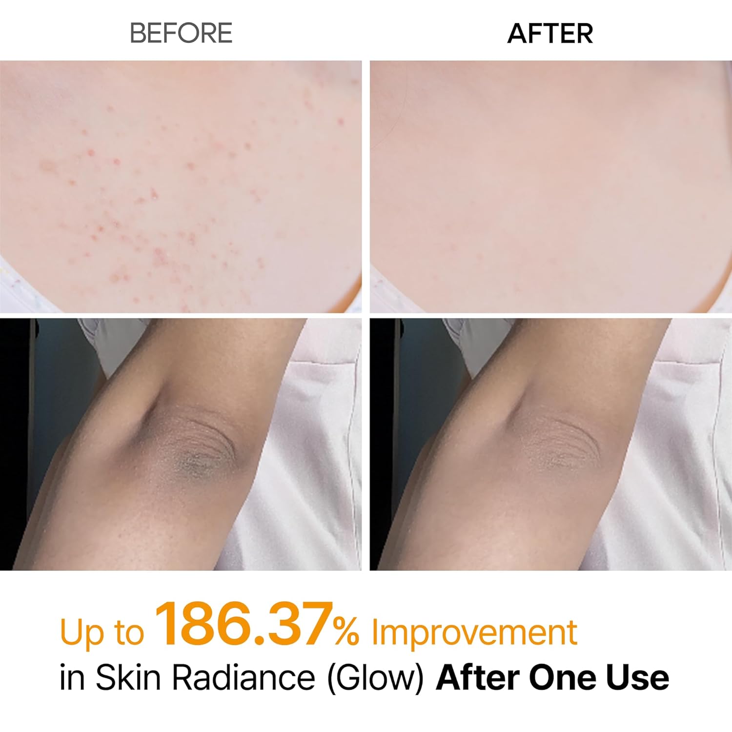 Advanced Glass Skin Peeling Solution