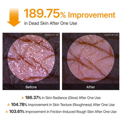 Advanced Glass Skin Peeling Solution